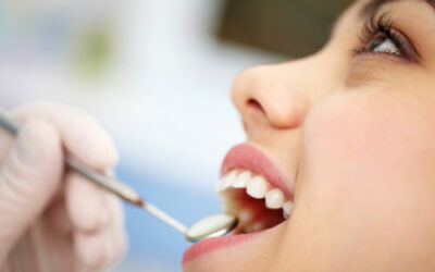 6 Steps to Prevent Gum Disease