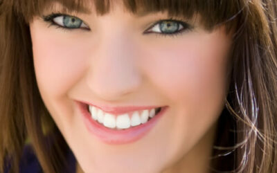 Teeth Whitening Houston: Why Use a Professional?