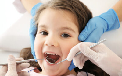 Does Your Child Need Dental Sealants?